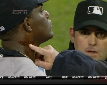 Pineda, de nuevo en la polémica: sería suspendido por usar una sustancia ilegal